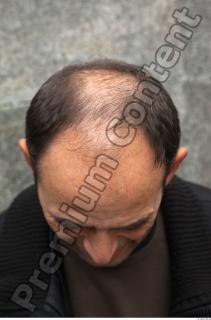 Forehead texture of street references 330 0001